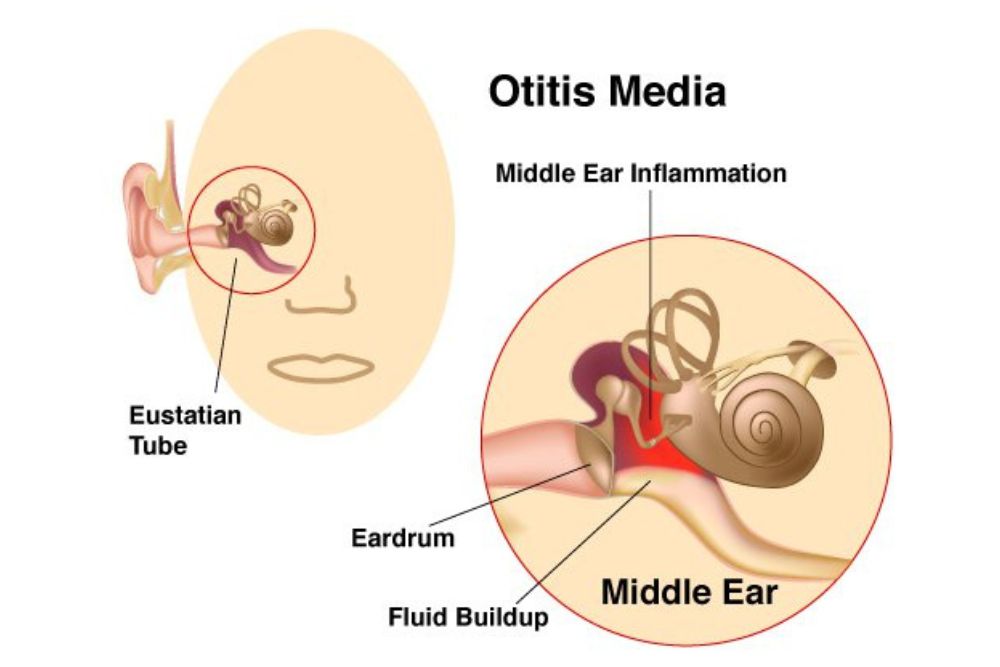 Ear Infection Doctor NYC